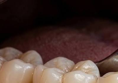 Teeth