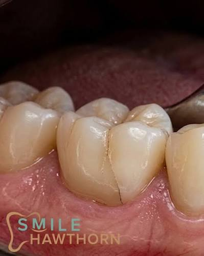 Teeth